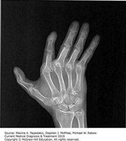 Current-Medical-Diagnosis-&-Treatment-2019-Buy-Now